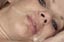 anus eclate